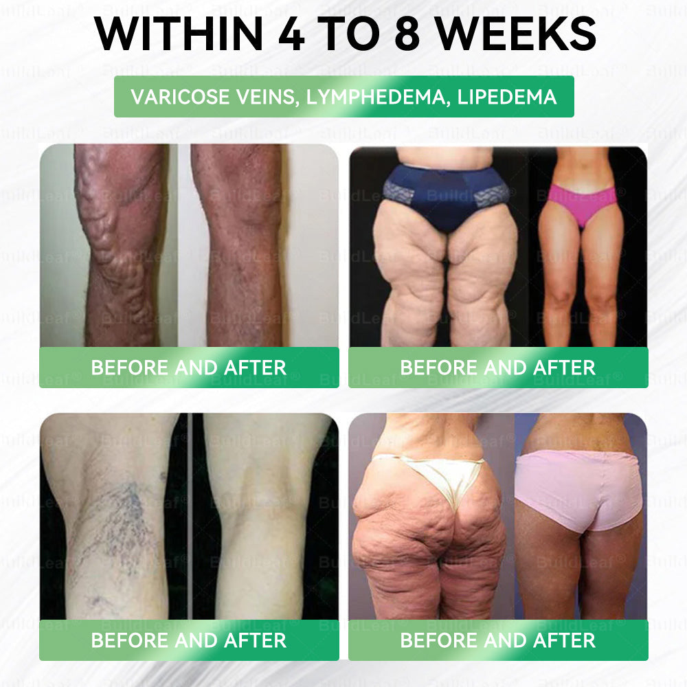 โค๏ธ๐บ๐ธBuildLeafยฎ GLP-1 8-in-1 Slim & Healthy Oral Solution (Once a day, results in 7 days), With 100 Billion CFU Active Probiotics โ
Supports weight management, heart health, diabetes, gut & womenโs health, while firming skin & boosting energy.