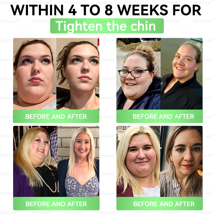 โค๏ธ๐บ๐ธBuildLeafยฎ GLP-1 8-in-1 Slim & Healthy Oral Solution (Once a day, results in 7 days), With 100 Billion CFU Active Probiotics โ
Supports weight management, heart health, diabetes, gut & womenโs health, while firming skin & boosting energy.