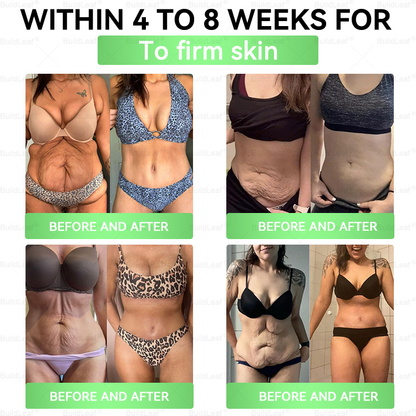 ❤️🇺🇸BuildLeaf® GLP-1 8-in-1 Slim & Healthy Oral Solution (Once a day, results in 7 days), With 100 Billion CFU Active Probiotics ✅ Supports weight management, heart health, diabetes, gut & women’s health, while firming skin & boosting energy.